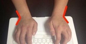 Wrist pain 002 Wrist pain 002